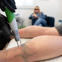 Evolve Tattoo Removal