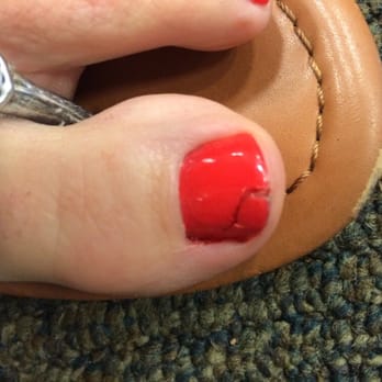 Number One Nails - Cracked nail 3 days after "Pamper Me pedi" - Nail Salons Near Me - Quartz Hill, California Number One Nails - Cracked nail 3 days after "Pamper Me pedi" - Nail Salons Near Me - Quartz Hill, California