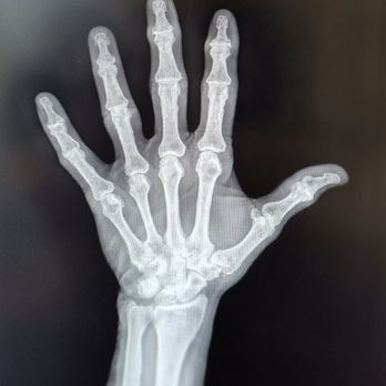 Levy Shoulder Center - Orthopedists Near Me - Boca Raton, Florida Levy Shoulder Center - Orthopedists Near Me - Boca Raton, Florida