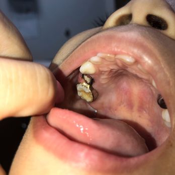 Diamond Dental - Cosmetic Dentists Near Me - Lake Elsinore, California