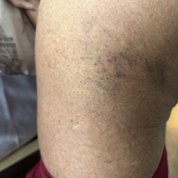Daniel Soom Attorney - Injury - Personal Injury Law Near Me - New Castle, Pennsylvania Daniel Soom Attorney - Injury - Personal Injury Law Near Me - New Castle, Pennsylvania