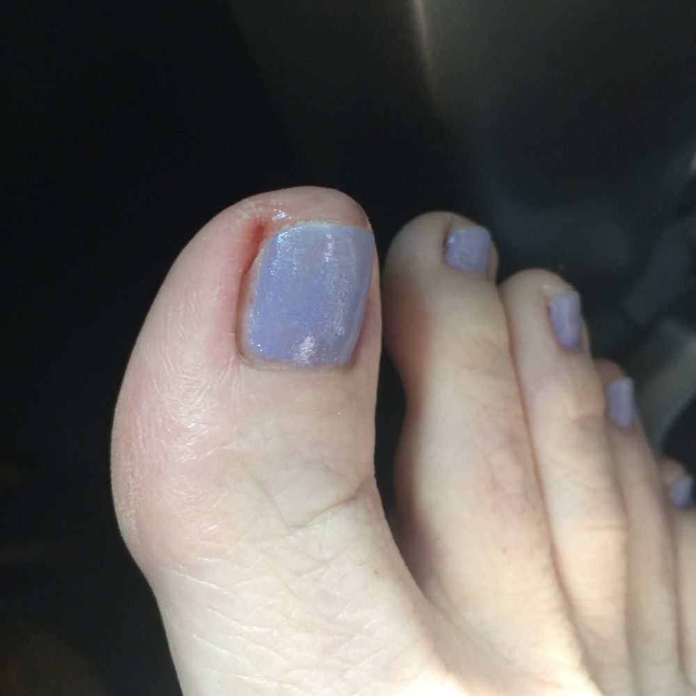 Angel Nails Sarasota - Worst pedicure. She completely missed the edges of my toes with the color. - Nail Salons Near Me - Sarasota, Florida Angel Nails Sarasota - Worst pedicure. She completely missed the edges of my toes with the color. - Nail Salons Near Me - Sarasota, Florida