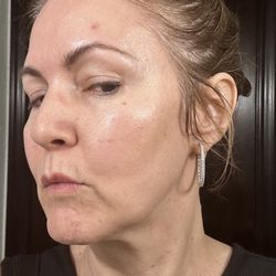 Athré Facial Plastics - Before photo