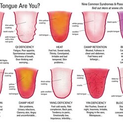 An overview of Tongue Diagnosis.