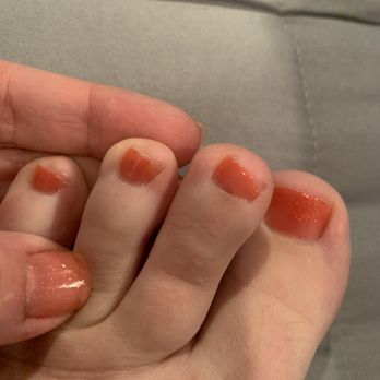 Lucky Nails - Nails and toes are supposed to be the same...from the same bottle. LOOK HOW BAD THEY CUT THEM !! They are all on an angle? - Nail Salons Near Me - Wayne, New Jersey