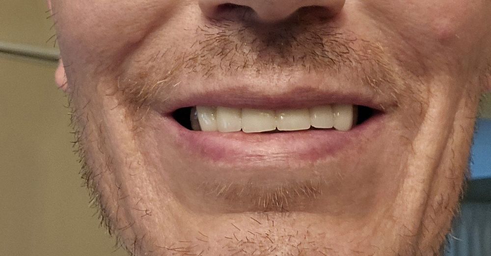 DIAMOND LAKE DENTAL Updated October 2024 31 Reviews 250 S Lyon