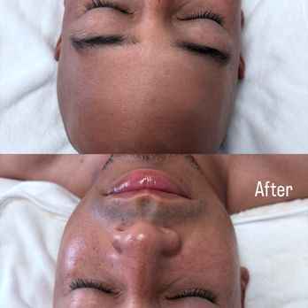 Skinn By Steph - Hydrating facial - Skin Care Near Me Skinn By Steph - Hydrating facial - Skin Care Near Me