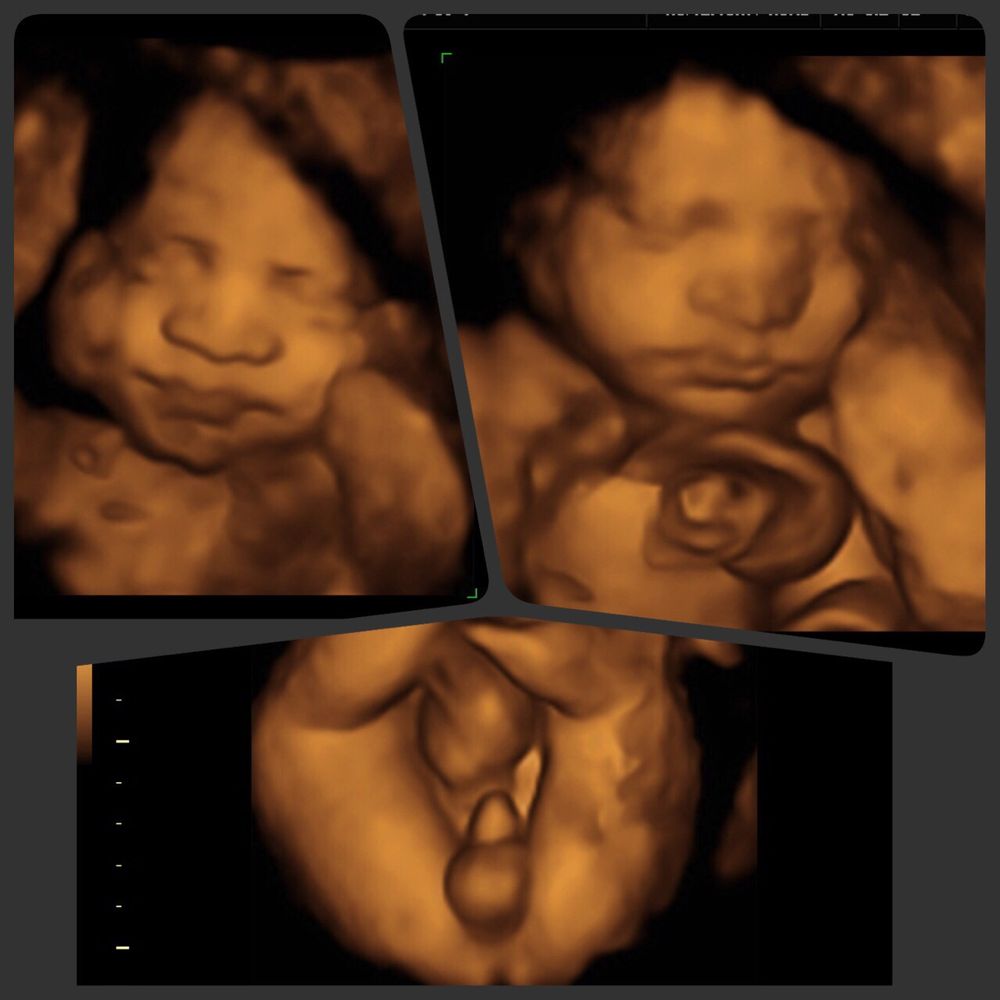 Photos for Baby Imaging 3D Ultrasound Studio Yelp