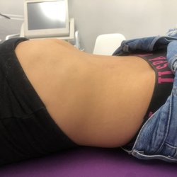 Beauty Moves - Lymphtic Drainage AFTER