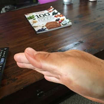 Sinless Sun Spray Tanning - My streaky hands. So disappointed. - Spray Tanning Near Me - Denver, Colorado Sinless Sun Spray Tanning - My streaky hands. So disappointed. - Spray Tanning Near Me - Denver, Colorado