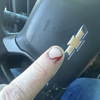 Boot Barn - Bloody finger from boot barn shelving - Shoe Stores Near Me - Greensboro, North Carolina