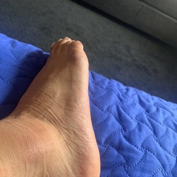 James C Wang, DPM - This is what it looked like before seeing Dr Wang - Podiatrists Near Me - Los Angeles, California James C Wang, DPM - This is what it looked like before seeing Dr Wang - Podiatrists Near Me - Los Angeles, California