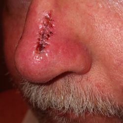 Bend Dermatology Clinic