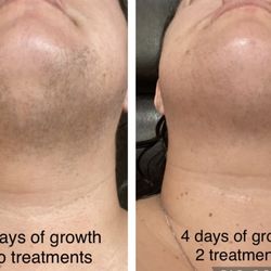 Organic Babe Electrolysis & Aesthetics