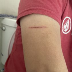 BioLife Plasma Services - Scratch