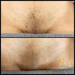 Rich Revenge Beauty - Brazilian Wax