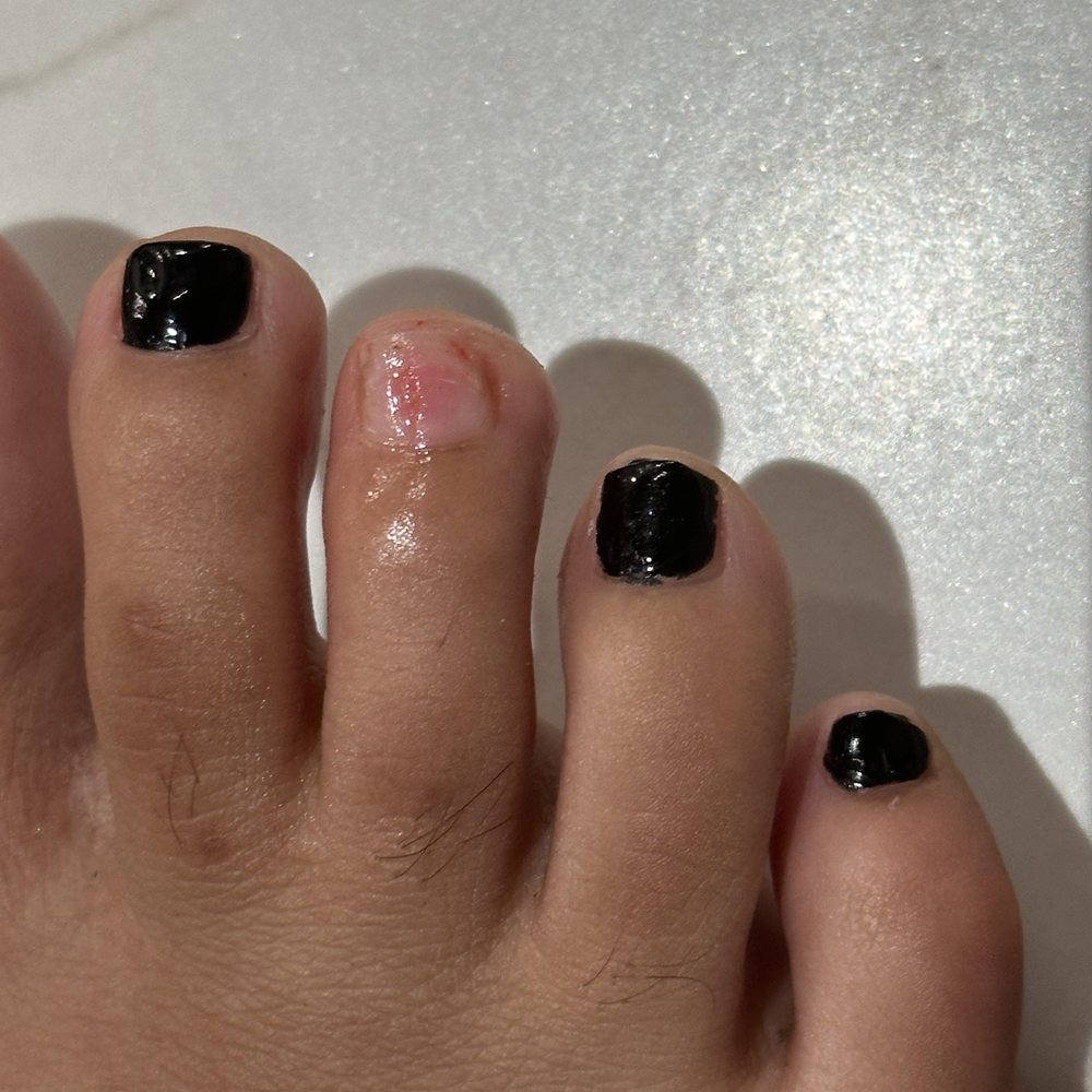 Queen Beauty Spa - I can not wear shoes socks for a while due to this bad service job - Nail Salons Near Me - Miami Beach, Florida Queen Beauty Spa - I can not wear shoes socks for a while due to this bad service job - Nail Salons Near Me - Miami Beach, Florida