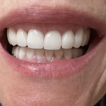 Dresen Restorative Dentistry - Thanks Dr Dresen! - General Dentistry Near Me - Woodbury, Minnesota Dresen Restorative Dentistry - Thanks Dr Dresen! - General Dentistry Near Me - Woodbury, Minnesota
