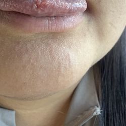 Angels Family Dental - He cut my tongue.
