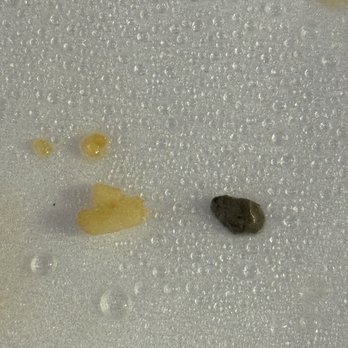 Panda Express - Metal chunk next to rice - Chinese Near Me - Flagstaff, Arizona Panda Express - Metal chunk next to rice - Chinese Near Me - Flagstaff, Arizona