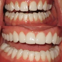 Family Dental Care