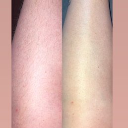 Before-left, after-right