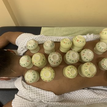 Lohas Healing Center - Acupuncture Near Me - Lomita, California Lohas Healing Center - Acupuncture Near Me - Lomita, California