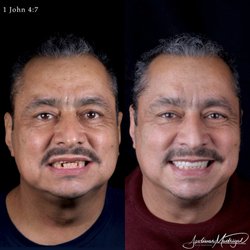 Trinity Dental & Implant Center - Full mouth rehabilitation