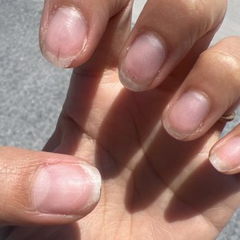 Cloud Nail Spa  - Removed nail polish--- all my nails are breaking which is why it's so uneven - Nail Salons Near Me - San Diego, California