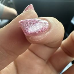 As you can see the nail goes from flat to lumps As you can see the nail goes from flat to lumps