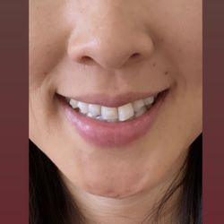 Luis Martines, DDS MSD - Larchmont Village Orthodontics - MAY 2022