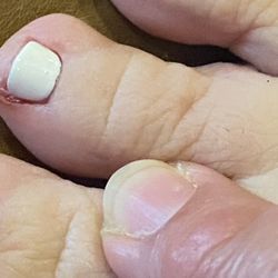 Top Nails