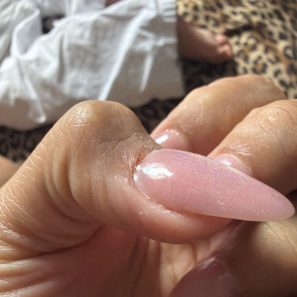 Where she cut me with the drill Where she cut me with the drill