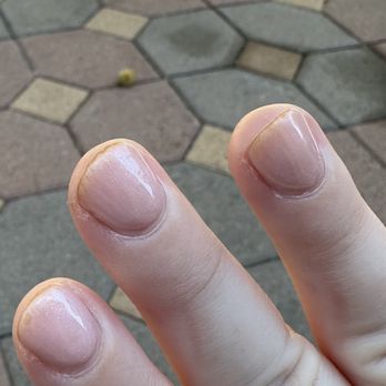 Nail 45 - Yellow staining and lifting after only 5 days. - Nail Salons Near Me - Los Angeles, California Nail 45 - Yellow staining and lifting after only 5 days. - Nail Salons Near Me - Los Angeles, California