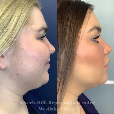 Beverly Hills Rejuvenation Center Westlake Village by null