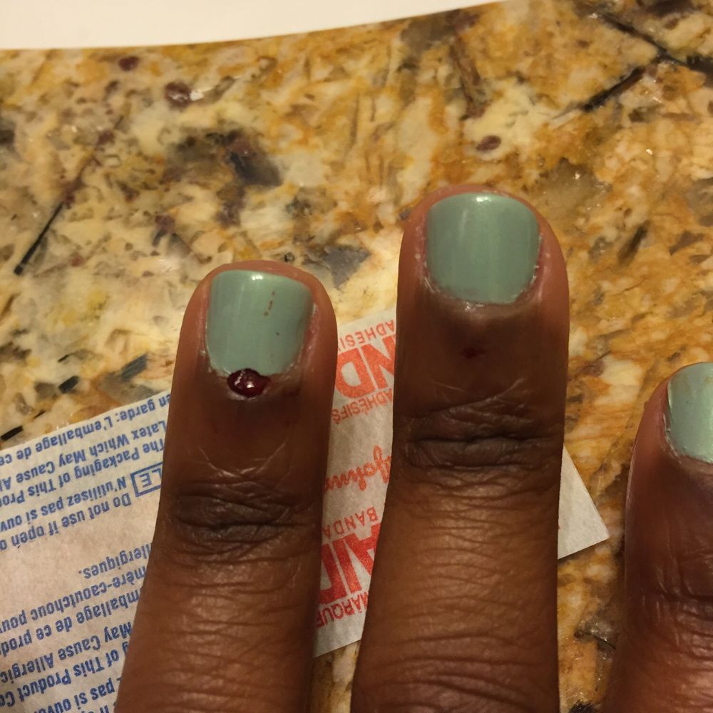 The Venus Experience - Bandaid and neosporin ouch butchered cuticle bed. - Day Spas Near Me - New Orleans, Louisiana The Venus Experience - Bandaid and neosporin ouch butchered cuticle bed. - Day Spas Near Me - New Orleans, Louisiana