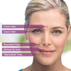 Dermal fillers like Radiesse or Juvéderm plump up the skin, replaces volume and encourages natural collagen production.