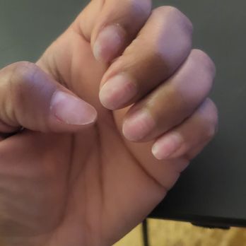 Linda Ocean Nails - My nails are healthy and strong I did not pull off my nails they popped off they were lifting underneath - Nail Salons Near Me - San Francisco, California Linda Ocean Nails - My nails are healthy and strong I did not pull off my nails they popped off they were lifting underneath - Nail Salons Near Me - San Francisco, California