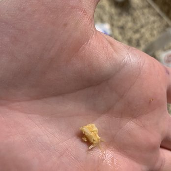 Monsoon Siam - A piece of a chickens claw - Thai Near Me - Madison, Wisconsin Monsoon Siam - A piece of a chickens claw - Thai Near Me - Madison, Wisconsin