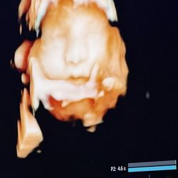 Enso Prenatal & 3D/4D Ultrasounds