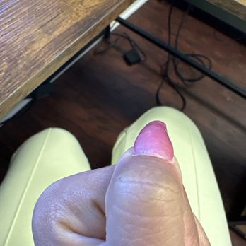 Milano Nail Spa Spring - Lifted nail - Nail Salons Near Me - Spring, Texas Milano Nail Spa Spring - Lifted nail - Nail Salons Near Me - Spring, Texas