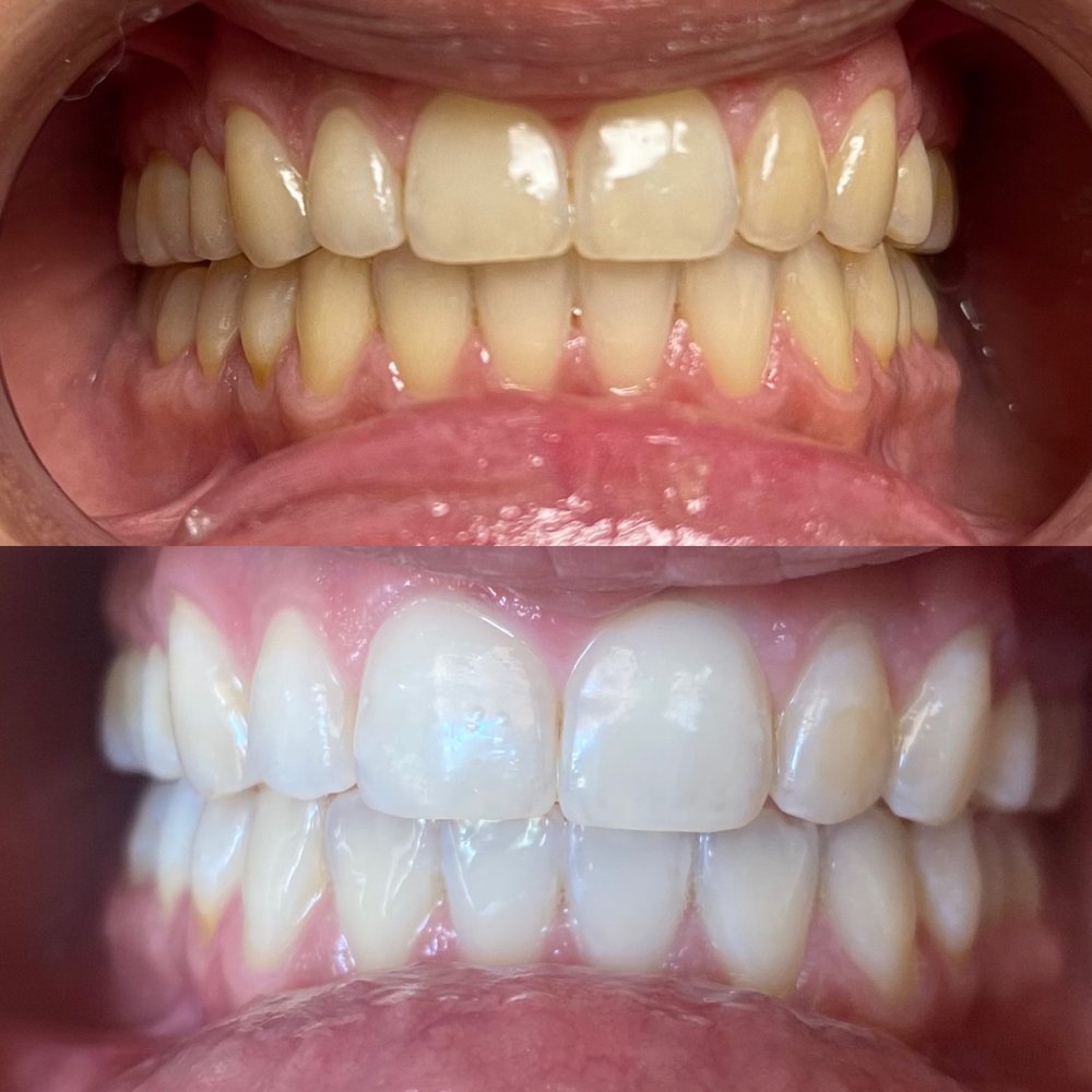 BRIGHTSMILEBYNAR Request an Appointment 2623 Honolulu Ave, Montrose