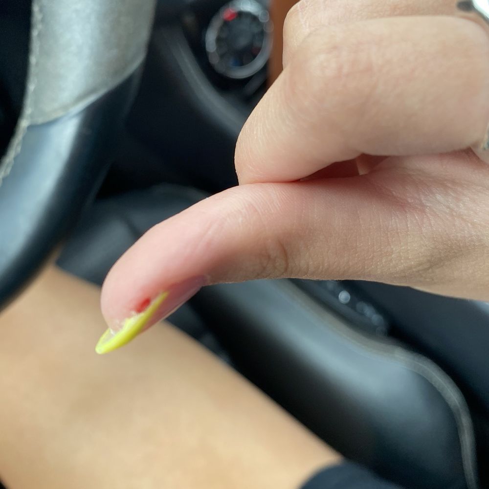 Sweet Nails and Spa - Bleeding thumb. - Waxing Near Me - Buda, Texas