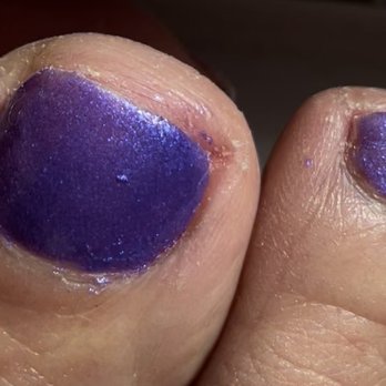 Pro Nails - Another sloppy pedicure. - Nail Salons Near Me - Gurnee, Illinois