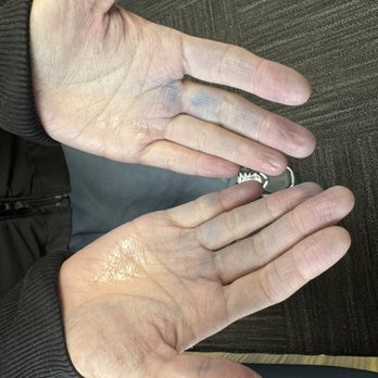 STech Auto Repair - BRING YOUR OWN PEN!!! Explosion of blue ink every where (was much worse... used 5 coats of sanitizer) - Auto Repair Near Me - Sunnyvale, California