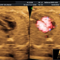 Eastside Maternal Fetal Medicine - Imaging of my daughter's heart was excellent quality.