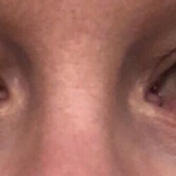 Springs Aesthetics - Before