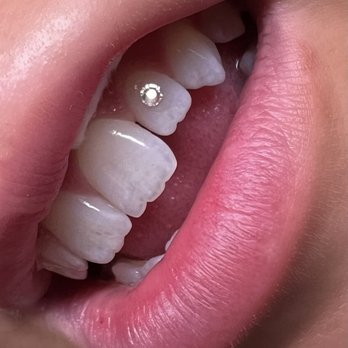 Imagine Esthetics - Tooth gem - Skin Care Near Me - Charlottesville, Virginia Imagine Esthetics - Tooth gem - Skin Care Near Me - Charlottesville, Virginia