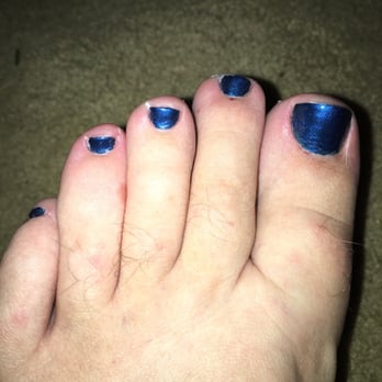 Sophie's Nail Spa - Small toe next to pinky toe is infected, a couple other toes have been nicked with the cuticle trimmer. - Nail Salons Near Me - San Anselmo, California Sophie's Nail Spa - Small toe next to pinky toe is infected, a couple other toes have been nicked with the cuticle trimmer. - Nail Salons Near Me - San Anselmo, California