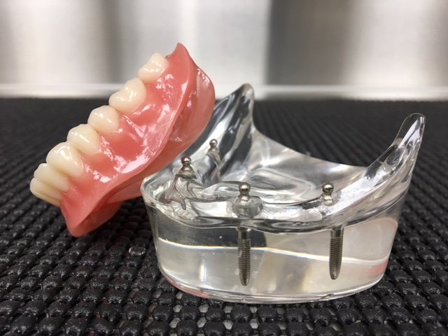 TRUE FIT DENTURE CENTRE - Updated February 2026 - 18 Photos - 504-7380 ...